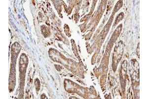 IHC-P Image Immunohistochemical analysis of paraffin-embedded human colon , using NDUFA10, antibody at 1:100 dilution.