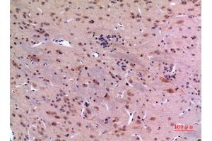 Immunohistochemistry (IHC) analysis of paraffin-embedded Rat Brain, antibody was diluted at 1:100.