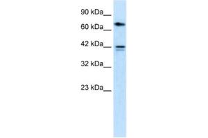 Western Blotting (WB) image for anti-Calcium Channel, Voltage-Dependent, beta 1 Subunit (CACNB1) antibody (ABIN2461080)