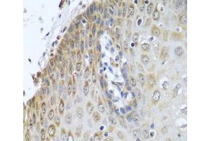 Immunohistochemistry of paraffin-embedded Human esophagus using POR Polyclonal Antibody at dilution of 1:100 (40x lens). (POR anticorps)