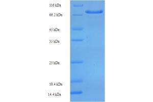 SDS-PAGE (SDS) image for Prolyl 4-Hydroxylase, Transmembrane (Endoplasmic Reticulum) (P4HTM) (AA 82-563) protein (His-SUMO Tag) (ABIN5711869)