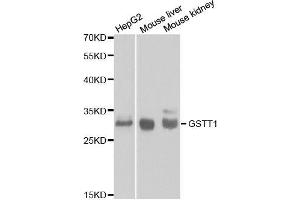 Western blot analysis of extracts of various cell lines, using GSTT1 antibody. (GSTT1 anticorps)
