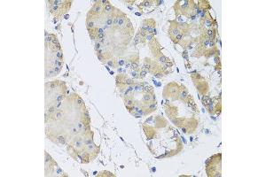 Immunohistochemistry of paraffin-embedded human gastric using RPLP1 antibody at dilution of 1:100 (x40 lens). (RPLP1 anticorps)