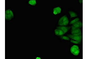 Immunofluorescent analysis of MCF-7 cells using ABIN7170794 at dilution of 1:100 and Alexa Fluor 488-congugated AffiniPure Goat Anti-Rabbit IgG(H+L) (STING/TMEM173 anticorps  (AA 207-379))