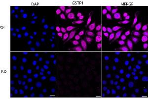 Immunocytochemical staining of HeLa cells using GSTP1 antibody (ABIN7798758), 1:1,000), Top panel: wild-type (WT), Bottom panal: GSTP1 shRNA knockdown (KD). (Recombinant GSTP1 anticorps)