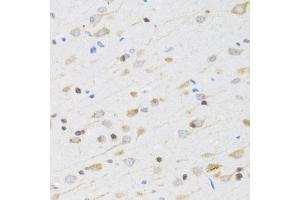 Immunohistochemistry of paraffin-embedded rat brain using CHRM5 antibody (ABIN1876555) at dilution of 1:100 (40x lens). (CHRM5 anticorps)