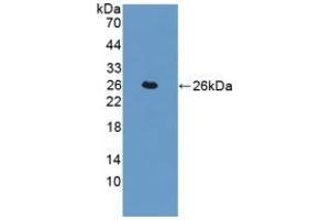Detection of Recombinant TAGLN, Human using Polyclonal Antibody to Transgelin (TAGLN)