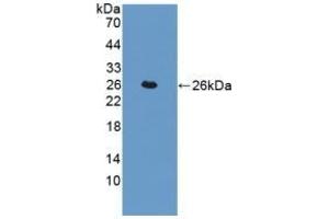 Detection of Recombinant TAGLN, Human using Polyclonal Antibody to Transgelin (TAGLN) (Transgelin anticorps  (AA 1-201))