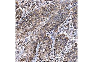 IHC analysis of SH2D4A using anti-SH2D4A antibody (ABIN7601695). (SH2D4A anticorps  (AA 42-454))