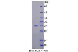 SDS-PAGE analysis of Human CDKN2D Protein.