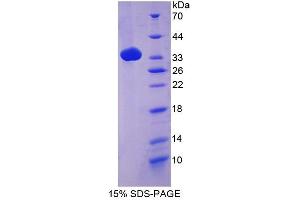 SDS-PAGE of Protein Standard from the Kit (Highly purified E.