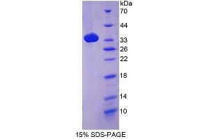 SDS-PAGE of Protein Standard from the Kit (Highly purified E. (Complement C4 Kit ELISA)