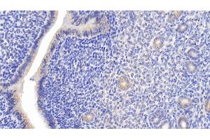 Detection of JNK1 in Mouse Uterus Tissue using Polyclonal Antibody to c-Jun N-terminal Kinase 1 (JNK1)