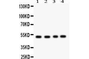 Western Blotting (WB) image for anti-Suppressor of Cytokine Signaling 4 (SOCS4) (AA 291-440) antibody (ABIN3043346) (SOCS4 anticorps  (AA 291-440))
