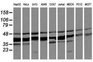 Image no. 1 for anti-Mitogen-Activated Protein Kinase Kinase 3 (MAP2K3) antibody (ABIN1499399)