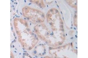 IHC-P analysis of Human Tissue, with DAB staining. (HGF anticorps  (AA 495-728))