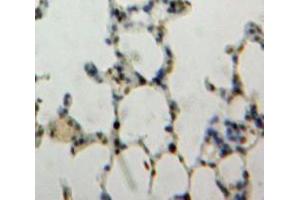 IHC-P analysis of Lung tissue, with DAB staining. (NUP88 anticorps  (AA 159-422))