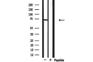 anti-Protein Inhibitor of Activated STAT, 3 (PIAS3) (N-Term) antibody