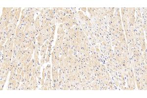 Detection of TNS1 in Human Cardiac Muscle Tissue using Polyclonal Antibody to Tensin 1 (TNS1)