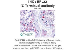 Image no. 2 for anti-Ribosomal Protein L22 (RPL22) (C-Term) antibody (ABIN1738940) (RPL22 anticorps  (C-Term))