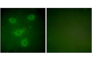 Immunofluorescence analysis of NIH-3T3 cells, using Keratin 14 Antibody.