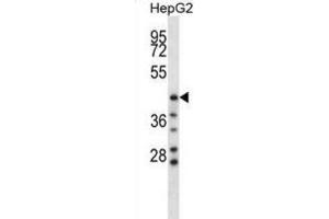 Western Blotting (WB) image for anti-Hyaluronidase-1 (HYAL1) antibody (ABIN2998320) (HYAL1 anticorps)