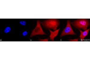 Immunocytochemistry/Immunofluorescence analysis using Mouse Anti-Ubiquitin Monoclonal Antibody, Clone 6C11-B3 . (Ubiquitin anticorps  (HRP))