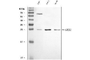 Western blot analysis of GRB2 using anti-GRB2 antibody (ABIN7599096).