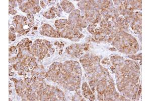 IHC-P Image Immunohistochemical analysis of paraffin-embedded SW480 xenograft, using BCL2L1, antibody at 1:500 dilution.