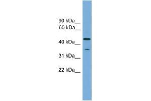 WB Suggested Anti-C6orf154 Antibody Titration: 0. (C6orf154 anticorps  (N-Term))