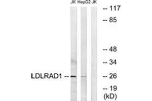 Western blot analysis of extracts from Jurkat/HepG2 cells, using LDLRAD1 Antibody. (LDLRAD1 anticorps  (AA 84-133))