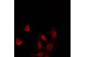 ABIN6268873 staining K562 by IF/ICC. (DREAM anticorps  (Internal Region))