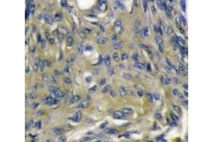 VEGFD antibody immunohistochemistry analysis in formalin fixed and paraffin embedded mouse heart tissue.