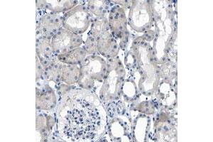 Immunohistochemical staining of human kidney with C1orf210 polyclonal antibody  shows nucleolar positivity in renal tubules. (C1ORF210 anticorps)