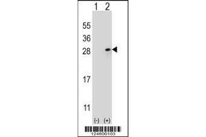 Western blot analysis of FGF9 using rabbit polyclonal FGF9 Antibody using 293 cell lysates (2 ug/lane) either nontransfected (Lane 1) or transiently transfected (Lane 2) with the FGF9 gene. (FGF9 anticorps  (N-Term))