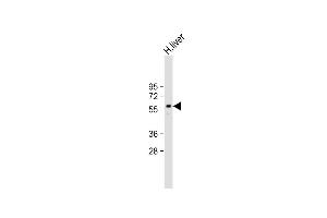Anti-ARG Antibody (N-term) at 1:2000 dilution + Human liver lysate Lysates/proteins at 20 μg per lane. (PPARG anticorps  (N-Term))
