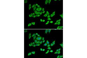 Immunofluorescence analysis of U2OS cells using OGDH antibody (ABIN6131413, ABIN6145002, ABIN6145004 and ABIN6216119). (alpha KGDHC anticorps  (AA 148-427))