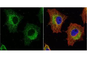 ICC/IF Image GSTP1 antibody [N1N2], N-term detects GSTP1 protein at cytoplasm by immunofluorescent analysis.