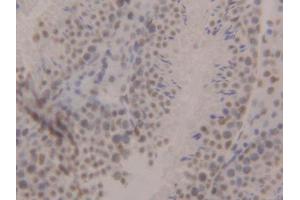 DAB staining on IHC-P; Samples: Mouse Testis Tissue (CBX3 anticorps  (AA 1-183))