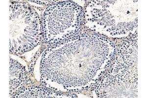 ABIN7096341 and ABIN7100403 at 1/100 staining rat testis tissue by IHC-P. (VCY, VCY1B anticorps)