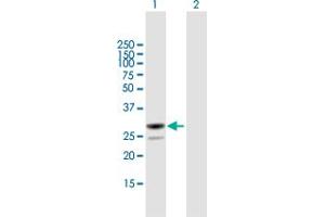 Western Blot analysis of MESDC2 expression in transfected 293T cell line by MESDC2 MaxPab polyclonal antibody. (MESDC2 anticorps  (AA 1-234))