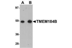 Western blot analysis with rat lung tissue lysate using TMEM184B Antibody at (A) 1 and (B) 2 μg/ml.