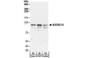 Western Blotting (WB) image for anti-Exosome Component 10 (EXOSC10) (AA 750-800) antibody (ABIN7454997)