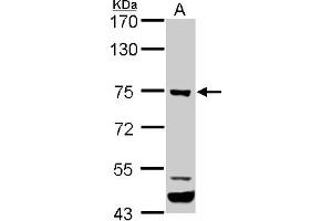 WB Image ELMO1 antibody [C3], C-term detects ELMO1 protein by western blot analysis.
