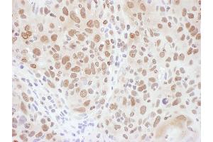 Immunohistochemistry (IHC) image for anti-Ring Finger Protein 20 (RNF20) (AA 125-175) antibody (ABIN7454669)
