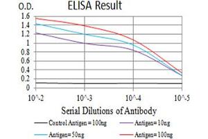 Black line: Control Antigen (100 ng),Purple line: Antigen (10 ng), Blue line: Antigen (50 ng), Red line:Antigen (100 ng)