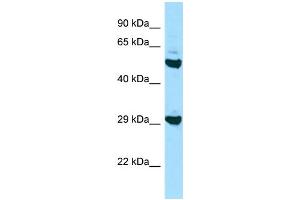 Western Blotting (WB) image for anti-Major Histocompatibility Complex, Class II, DO beta (HLA-DOB) (N-Term) antibody (ABIN2435823) (HLA-DOB anticorps  (N-Term))