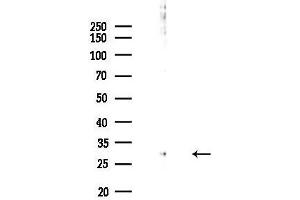 anti-Ring Finger Protein 144A (RNF144A) (Internal Region) antibody