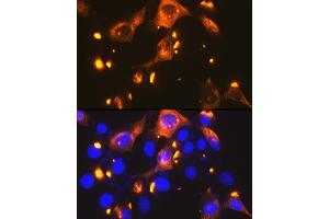 Immunofluorescence analysis of NIH-3T3 cells using GLUT2/SLC2 Rabbit mAb (ABIN7270414) at dilution of 1:100 (40x lens).
