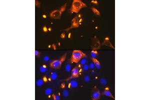 Immunofluorescence analysis of NIH-3T3 cells using GLUT2/SLC2 Rabbit mAb (ABIN7270414) at dilution of 1:100 (40x lens). (SLC2A2 anticorps)